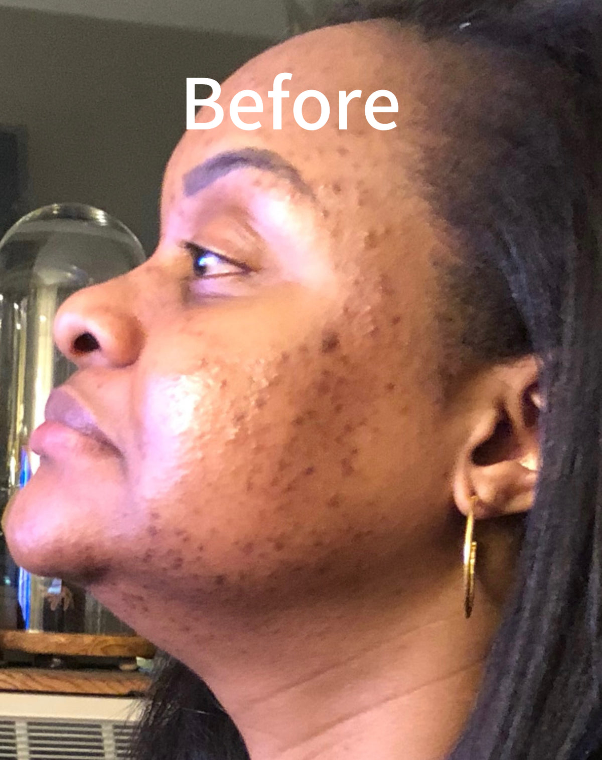 "Be Still and Know skincare product by My Store designed for breakout-prone oily skin, featuring a soothing formula in a white bottle."