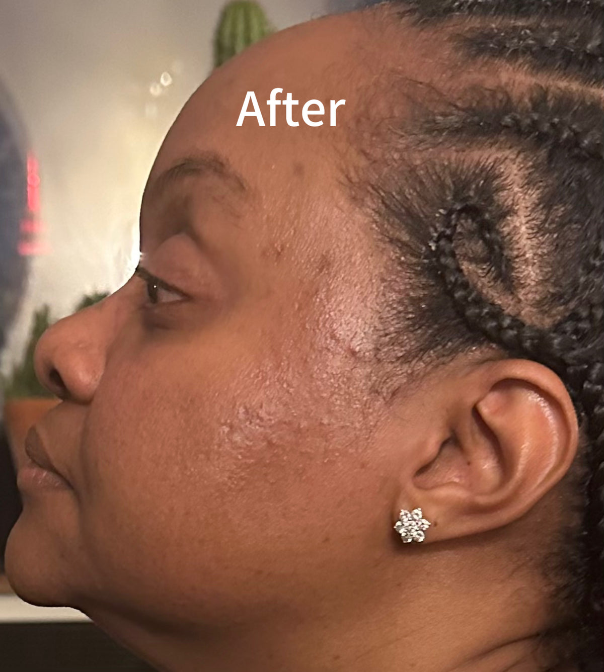 "Be Still and Know skincare product for breakout-prone, oily skin by My Store, featuring a soothing formula in a sleek container."